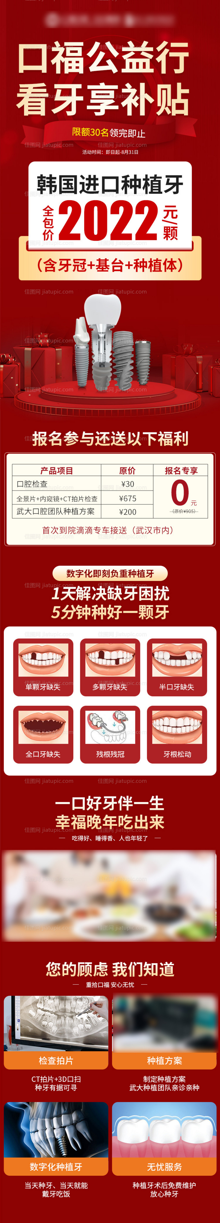 种植牙活动发布会活动图-源文件